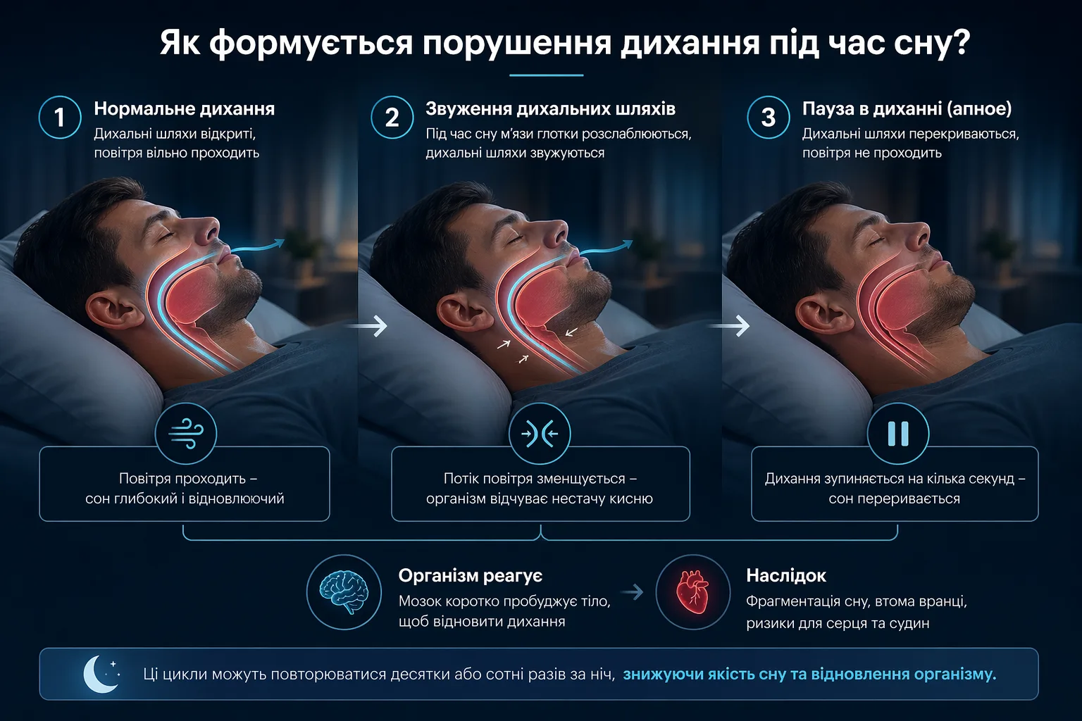 Сон без хропіння та апное: як спадковість впливає на якість нічного дихання та відпочинку? — фото 2
